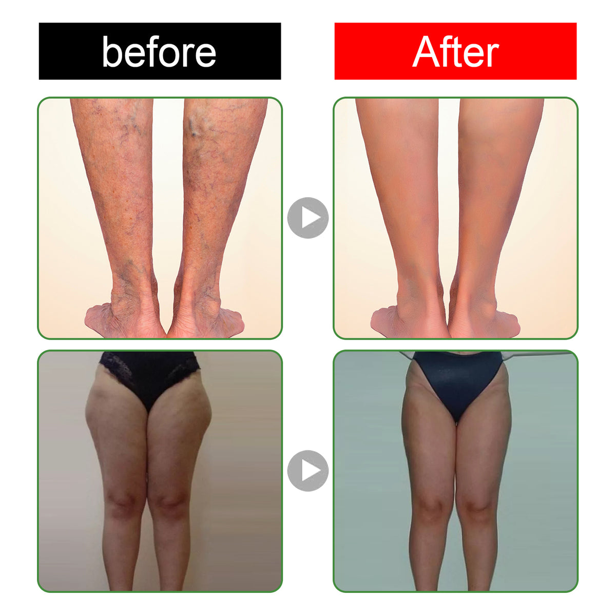 Herbal Foot Pads – 10 or 30 Pieces