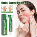 Herbal Eczema Ointment, Relieve Hand And Foot Moss Skin Redness Itchy Skin Repair Ointment