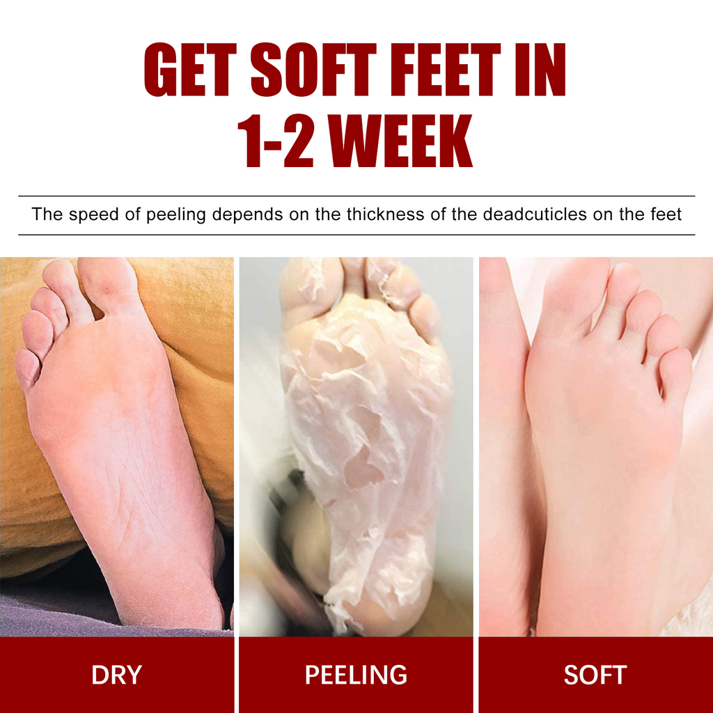 Exfoliating Foot Mask – Malic Acid and Salicylic Acid