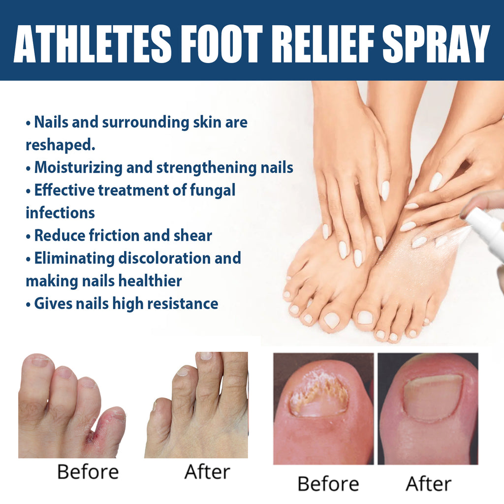 Athletes Foot Relief Spray, Relieve Foot Sweat Foot Itching Peeling Gray Nails Foot Odor Moisturizing Care Spray