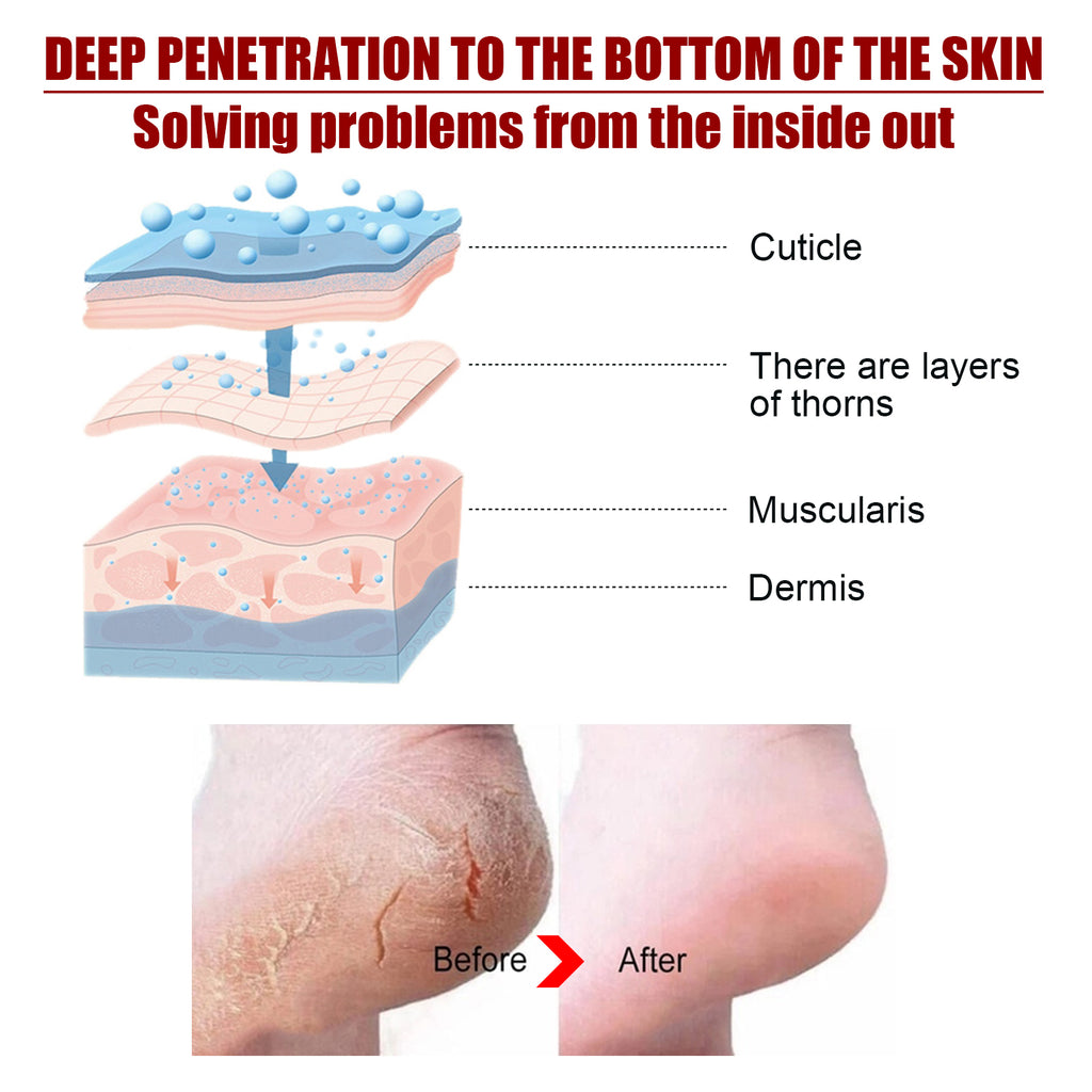 Exfoliating Foot Mask – Malic Acid and Salicylic Acid
