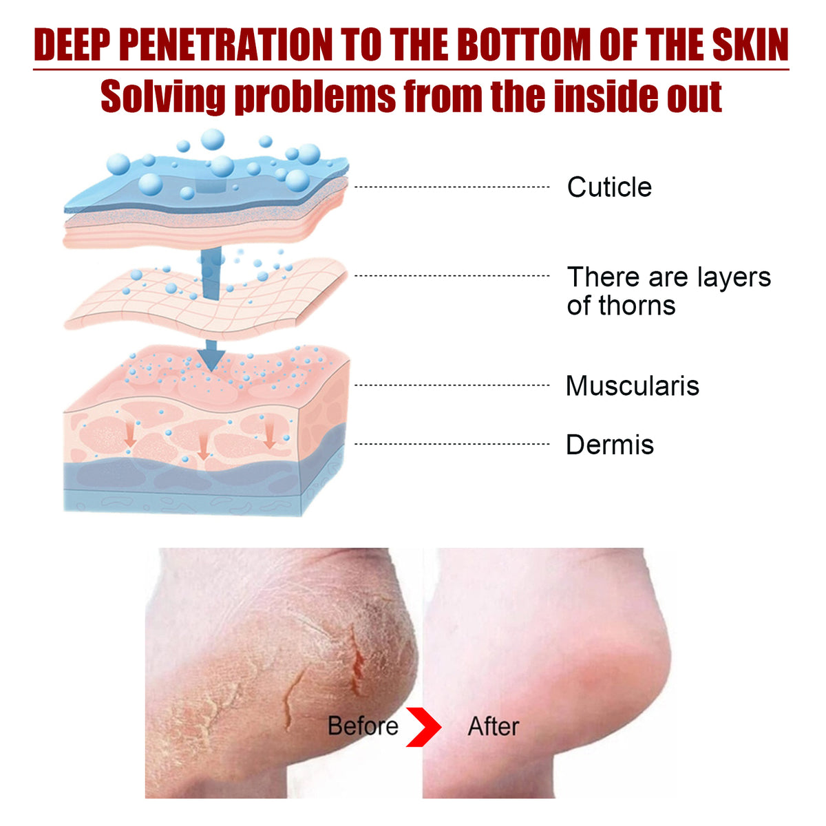 Exfoliating Foot Mask – Malic Acid and Salicylic Acid